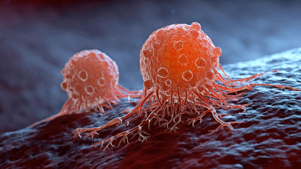 Los dos pilares contra el cáncer: cómo prevenirlo desde la evidencia científica
